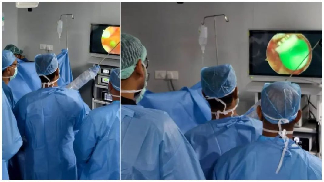 വയനാട് ഗവ. മെഡിക്കല് കോളേജില് ആര്ത്രോസ്കോപ്പിക് റൊട്ടേറ്റര് കഫ് റിപ്പയര് വിജയകരം