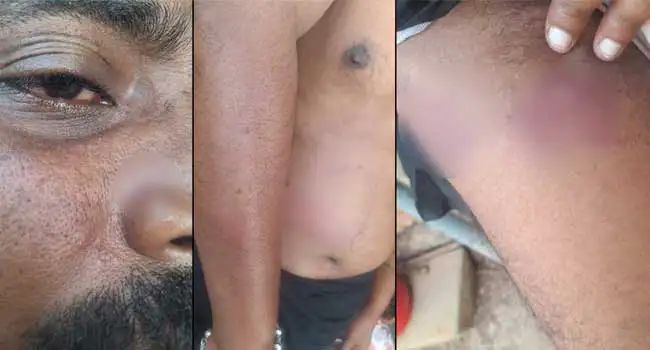 ആളുമാറി പോലീസ് മര്ദ്ദിച്ചെന്ന് യുവാവിന്റെ പരാതി