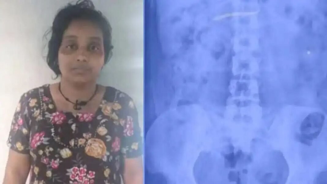കുട്ടിയുടെ സ്വര്ണമാല മോഷ്ടിച്ച് വിഴുങ്ങി; യുവതി അറസ്റ്റില് കുട്ടിയുടെ സ്വര്ണമാല മോഷ്ടിച്ച് വിഴുങ്ങി; യുവതി അറസ്റ്റില്