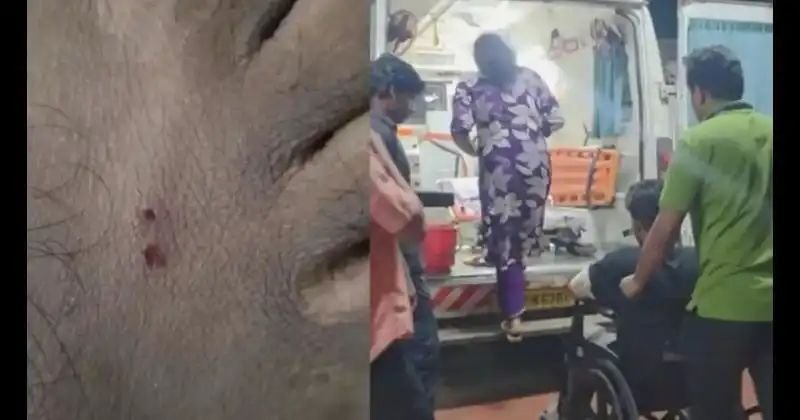 കോഴിക്കോട് താമരശ്ശേരിയില് രണ്ട് പേര്ക്ക് പാമ്പ് കടിയേറ്റു കോഴിക്കോട് താമരശ്ശേരിയില് രണ്ട് പേര്ക്ക് പാമ്പ് കടിയേറ്റു