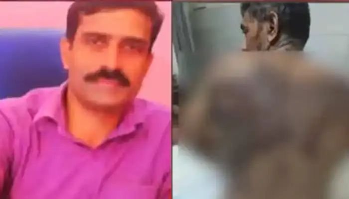 യുവാവിന് നേരേ ആസിഡ് ആക്രമണം; അയല്വാസി അറസ്റ്റില് യുവാവിന് നേരേ ആസിഡ് ആക്രമണം; അയല്വാസി അറസ്റ്റില്