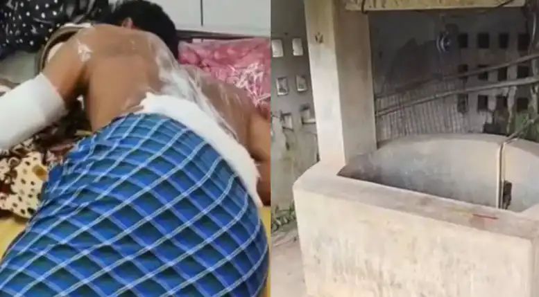 കിണറിനുള്ളില് നിന്നും തീ ആളിപടര്ന്നു; മൂന്ന് യുവാക്കള്ക്ക് ഗുരുതര പൊള്ളല് കിണറിനുള്ളില് നിന്നും തീ ആളിപടര്ന്നു; മൂന്ന് യുവാക്കള്ക്ക് ഗുരുതര പൊള്ളല്