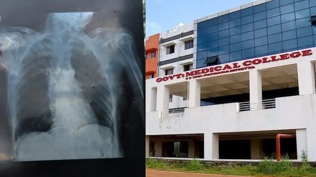16കാരിക്ക് നല്കിയത് 88കാരിയുടെ എക്സ് റേ; കോന്നി മെഡിക്കല് കോളേജ് ആശുപത്രിക്കെതിരെ പരാതി 16കാരിക്ക് നല്കിയത് 88കാരിയുടെ എക്സ് റേ; കോന്നി മെഡിക്കല് കോളേജ് ആശുപത്രിക്കെതിരെ പരാതി